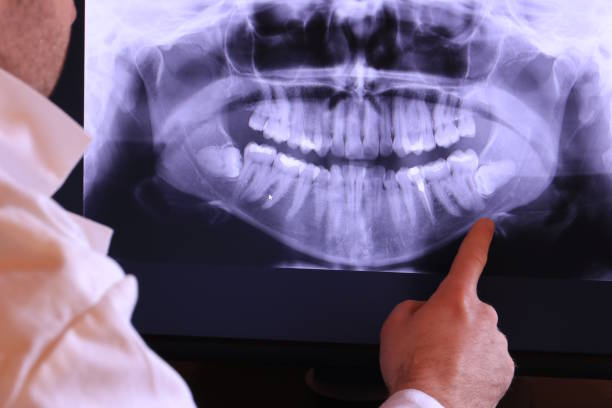 Best Pediatric Emergency Dentist in Tecumseh, OK